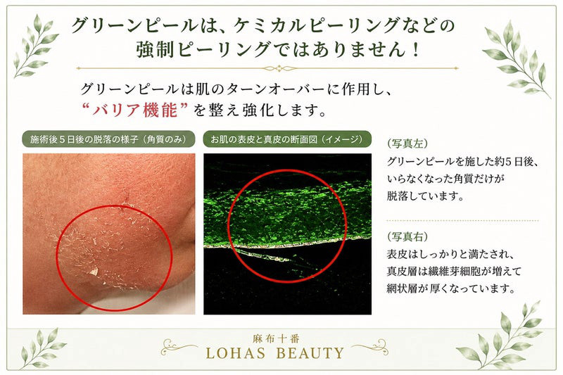グリーンピールはピーリングではない