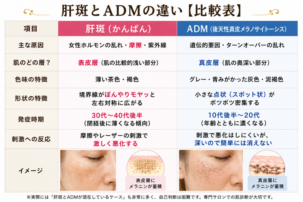 肝斑とADMの違いと比較表
